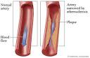 The Dangers Of Developing Diabetes And Heart Disease