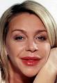 Before and after: Actress Leslie Ash pictured before and after a doctor ... - article-0-0067C9ED00000258-690_224x323