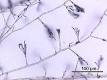 hyphae pronunciation
