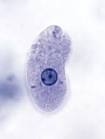 <b>Amebiasis</b>