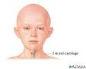 Cricoid cartilage: MedlinePlus Medical Encyclopedia Image