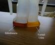 Choluria – Dark urine – Liver disease