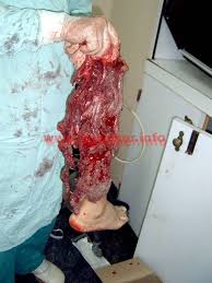 http://t1.gstatic.com/images?q=tbn:ANd9GcSXacvF5HMU3-474qO1HmLlu7dbXbxo71MUw-CFj6cNSkAazW0&t=1&usg=__PPcH7jzDqxaNU0VmUpXI76U1y-8=
