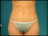http://t1.gstatic.com/images?q=tbn:ANd9GcSXcJCYvbE4ZYWRJDgUCRiqgMwivG5AOCUa5gZz7A5TdZw8tB-sK8qEC54lpg