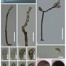 Image result for Conidiospores verruculosa