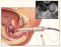 Crete Fertility Centre, IVF, IUI, ICSI, PGD fertility treatments ...