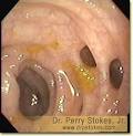 W. Perry Stokes, Jr., M.D., F.A.C.G.
