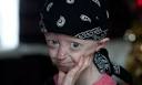 Progeria campaigner HAYLEY OKINES dies at 17 | UK news | The Guardian