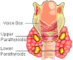 <b>Hypoparathyroidism</b> requires