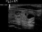 File: Ultrasound Scan ND 0107091941 0928400.png - Wikimedia Commons