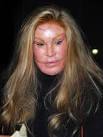 The Worst Celebrity Plastic Surgery Disasters Bitten and Bound