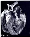Feline Hypertrophic Cardiomyopathy