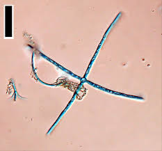 Resultado de imagen para Lemonniera centrosphaera