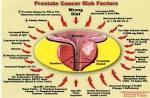 Prostate Cancer Risk Factors