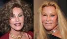 Plastic Surgeries Gone Wrong at WomansDaycom   Bad Celebrity