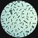 Clostridium botulinum » Gram-Positive Bacteria » Pathogen Profile ...