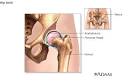 Drawing of a normal <b>hip joint</b>