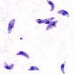 <b>Toxoplasma</b> gondii