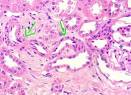 arteriola