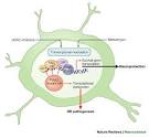 of Huntington's disease