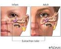  Eustachian tube : Medline Plus Medical Encyclopedia Image