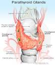 of <b>hypoparathyroidism</b> is