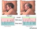 NARCOLEPSY