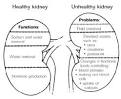 <b>Renal insufficiency</b>, also