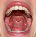  Mucous Membrane - a comprehensive view - Wellsphere