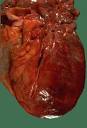 Cardiovascular Pathology