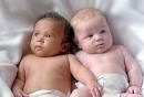 Tipos de <b>gemelos</b> | NotiBebes