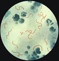 Streptococcus pyogenes » Gram-Positive Bacteria » Pathogen Profile ...