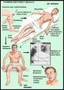 Korsakoffs syndrome Pictures, Korsakoffs syndrome Image, Medical ...