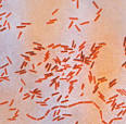 <b>Salmonella typhi</b>, the agent of