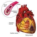 What does Cerebrovascular Disease look like? Are you also ...