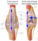 HOW TO Care for Your Dog's Luxating Patella | Find A Vet