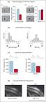 ScienceDirect.com - Current Opinion in Neurobiology - Lifelong ...