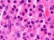<b>Plasma cell</b>