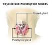 Hyperparathyroidism - Wikipedia, the free encyclopedia