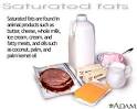 Saturated fats: MedlinePlus Medical Encyclopedia Image