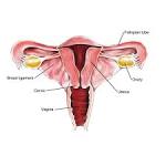 Ovarian Cancer