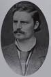 History. In 1887, Adolf Fick