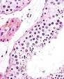 <b>Espermatogénesis</b>