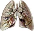 Pulmonary and Critical Care Medicine