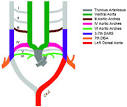 Cardiology For You: Aortic Arch Anomalies