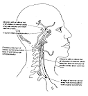 CEREBROVASCULAR DISEASE