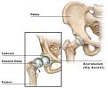 Hip Arthroscopy - Hip Anatomy &amp; Hip Pain Causes, New York