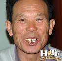 China Tooth
