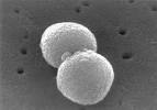 Le <b>pneumocoque</b> est aussi