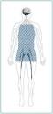 Diabetic Neuropathies: The Nerve Damage of Diabetes - National ...